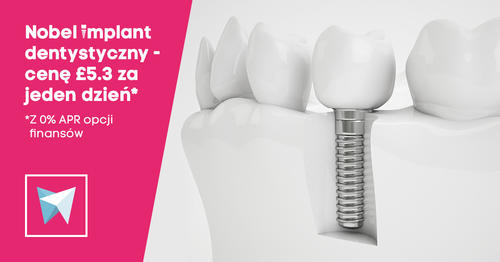 Wysokiej jakości implanty stomatologiczne od £5.3 dziennie!