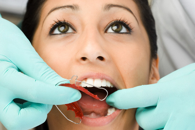 Polski dentysta w Londynie - Ortodoncja