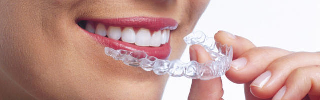 Standardowy aparat na zęby czy niemal przezroczyste nakładki Invisalign®?