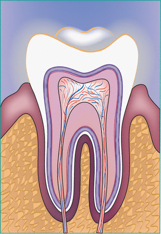 Root Canal Treatment